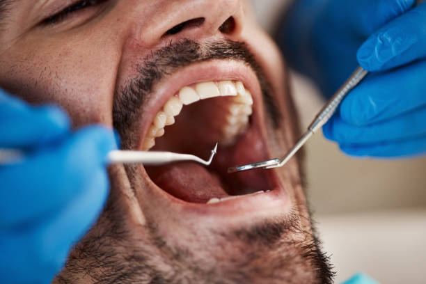Best Emergency Treatment for Dental Infections or Abscesses in Laurel Hill, VA
