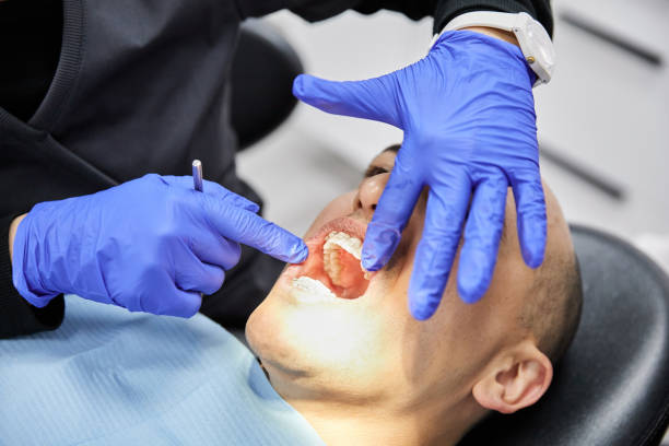 Best Emergency Dental Care for Broken or Chipped Teeth in Laurel Hill, VA