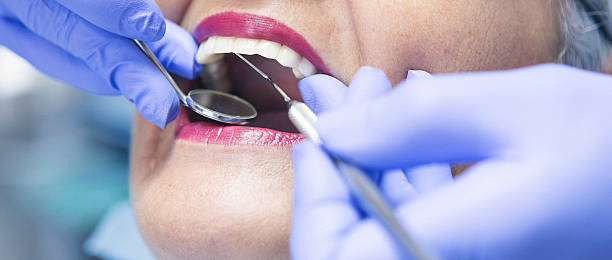 Best Emergency Dental Care for Broken or Chipped Teeth in Laurel Hill, VA